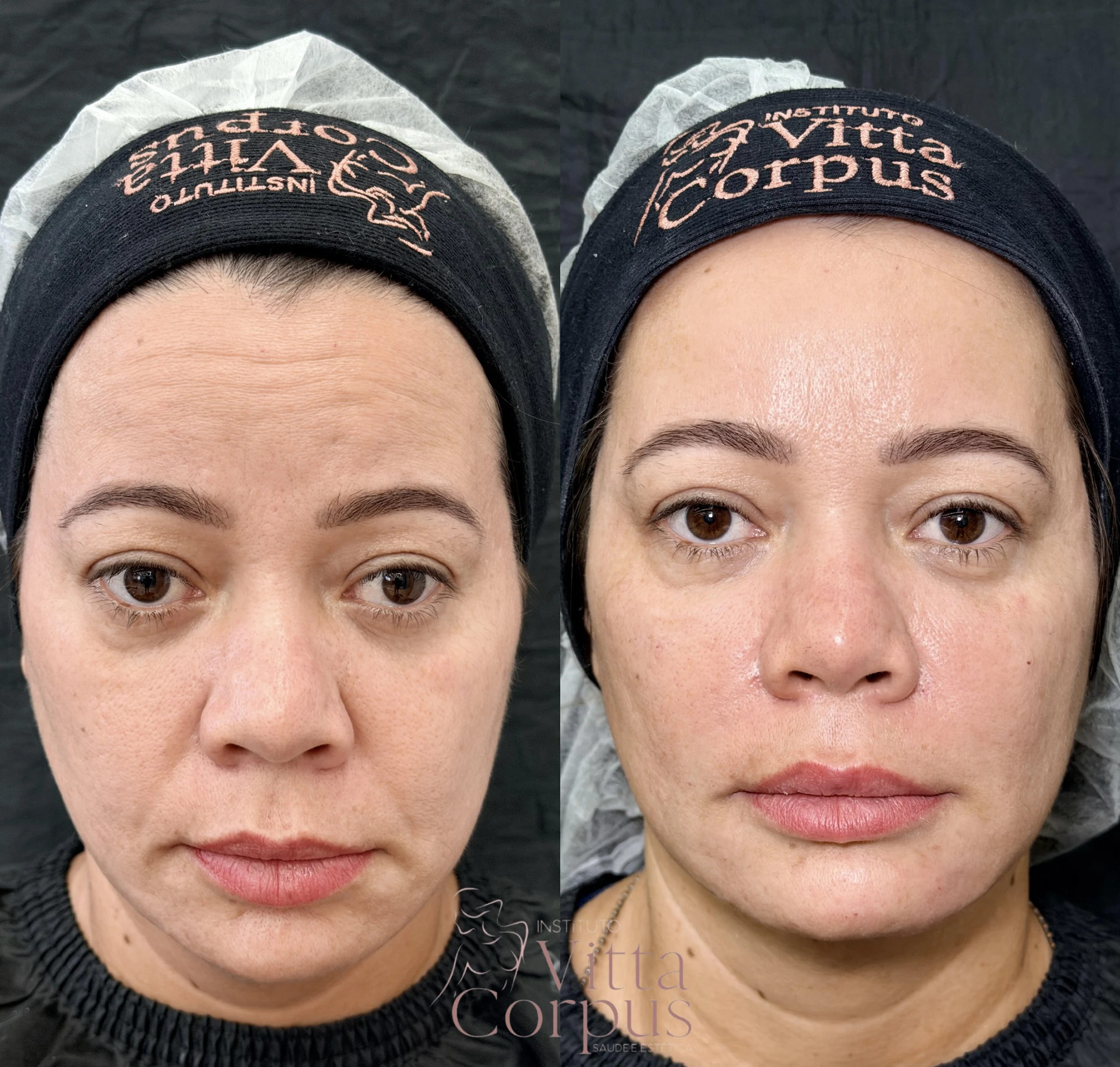Comparativo de antes e depois do case 4