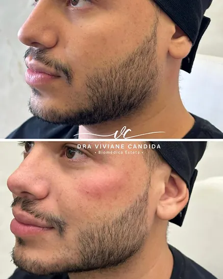 Comparativo de antes e depois do case 2